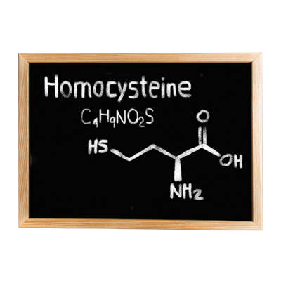 Homocysteine